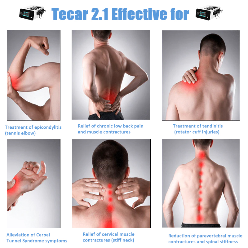 Tecar therapy -2.1.jpg
