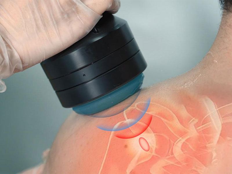 Shockwave-Therapy.jpg