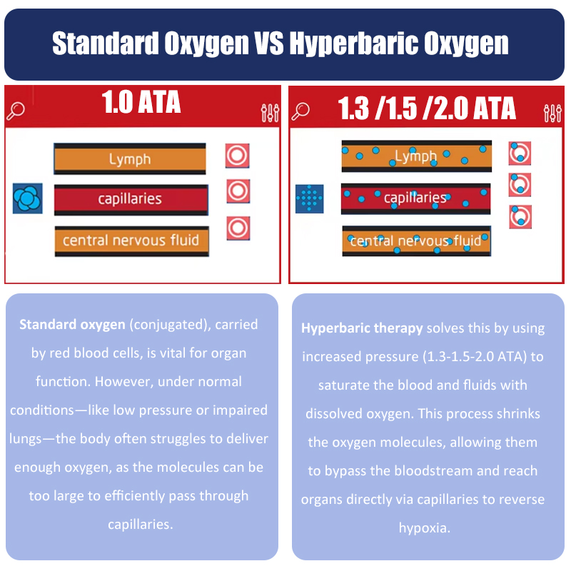 HBOT Oxygen.jpg