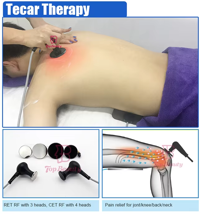 Shockwave Therapy (2).png