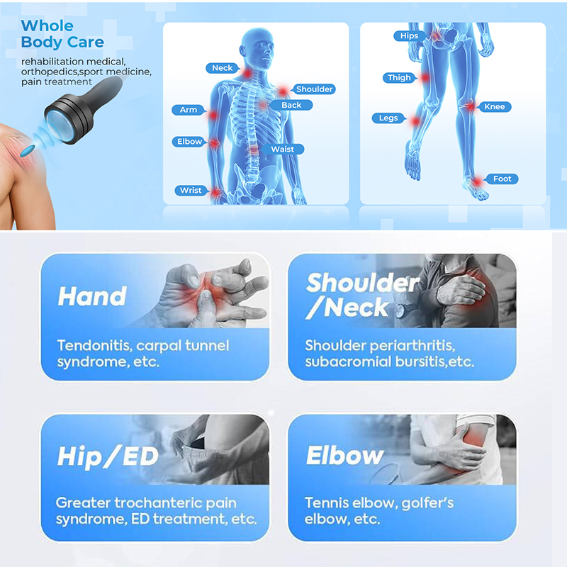 Focused shockwave therapy treatment device in clinical setting